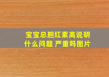 宝宝总胆红素高说明什么问题 严重吗图片